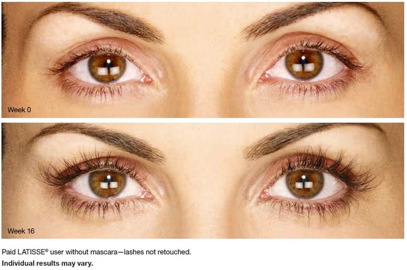 we now carry latisse! 1 latisse3